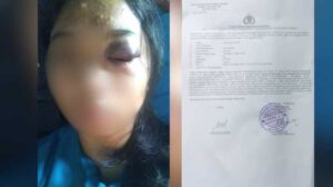 Diduga Dianiaya Kepala Sekolah, Keluarga Korban Siswa SMP Negeri 4 Tojo Tuntut Keadilan di Polres Tojo Unauna